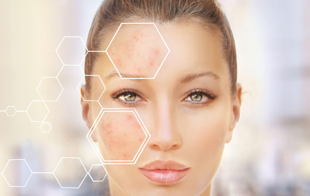 Dermis Scare removel 1024x647 1